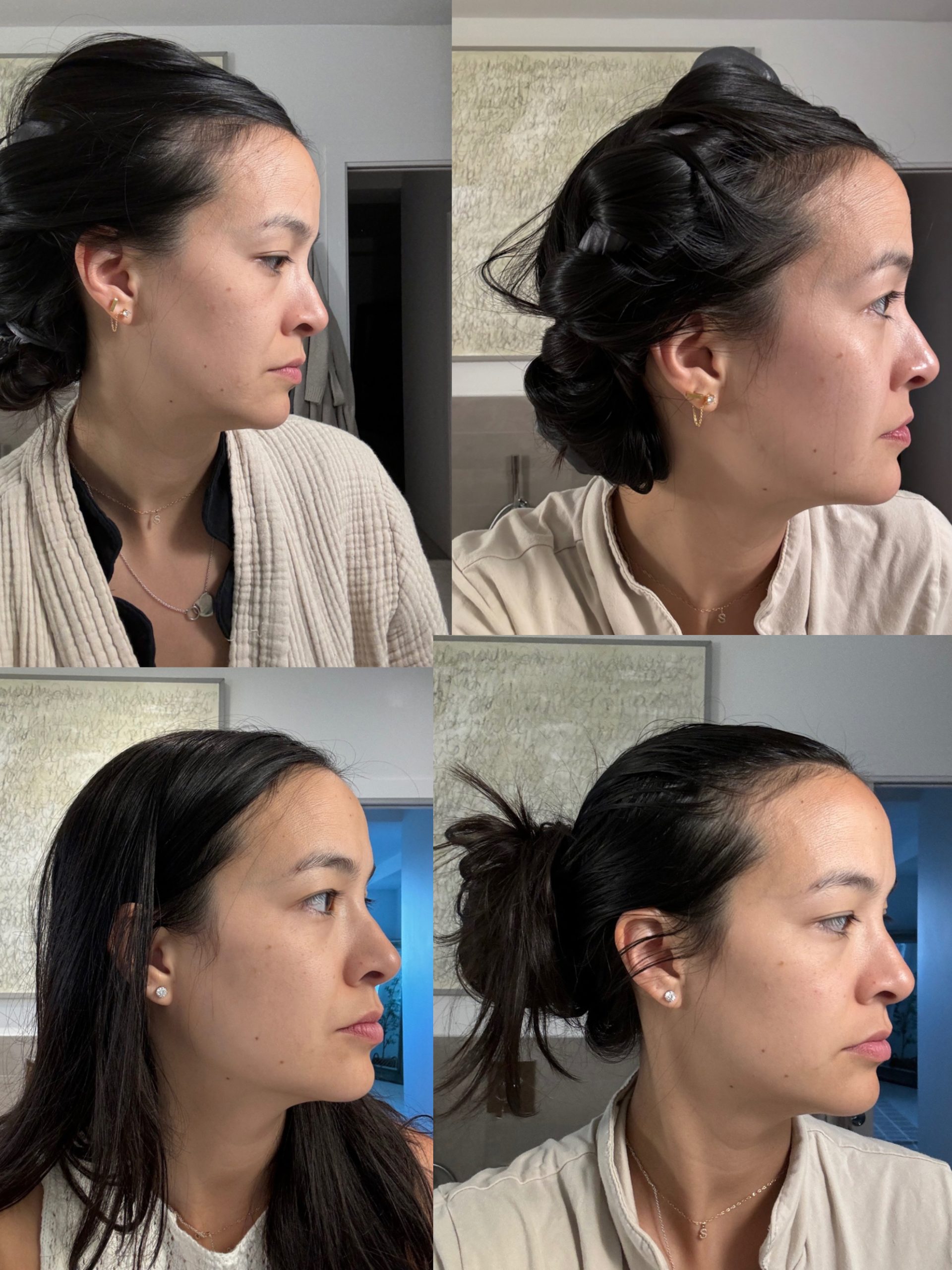 Omnilux Contour Face Redlight therapy mask review and results - a womans side profile over 4 weeks with visibly fewer wrinkles